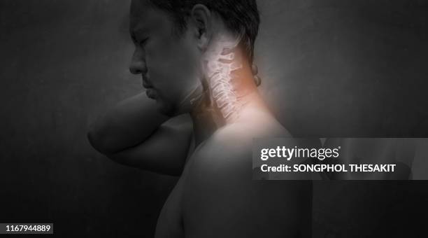 men who have neck pain due to cervical spondylosis  he must hurry to see a doctor for treatment. - x ray human stock pictures, royalty-free photos & images