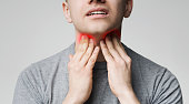 Young man pulping his inflamed neck, close up