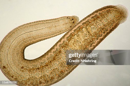 Leech micrograph Leech micrograph