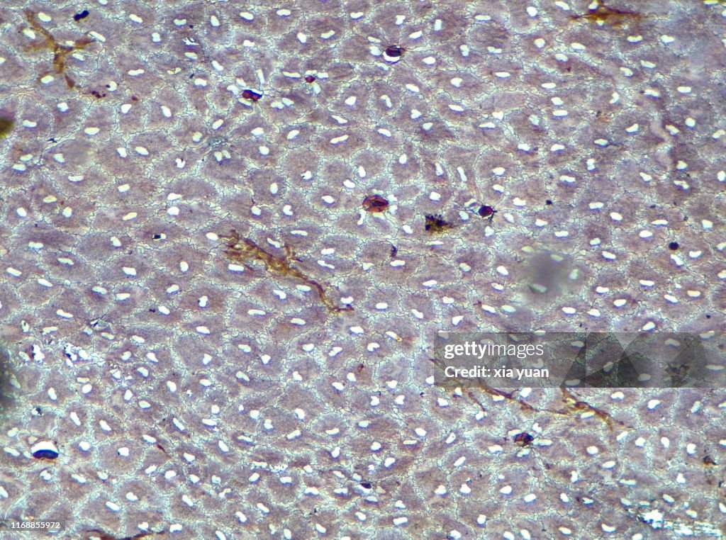 Simple Squamous Epithelium 10x Light Micrograph High-Res Stock Photo ...