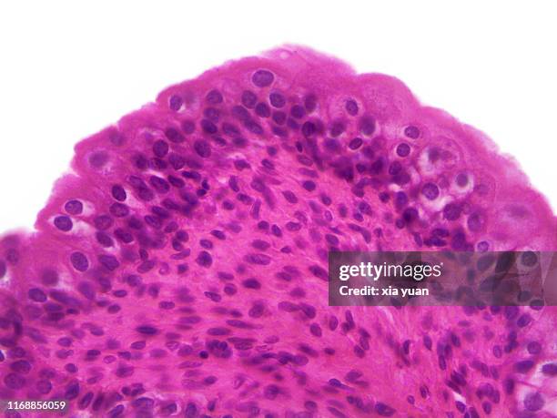 transitional epithelium of the urinary bladder,40x light micrograph - zellmembran stock-fotos und bilder