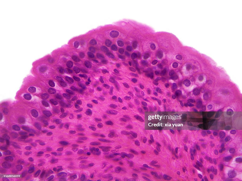 Transitional Epithelium Of The Urinary Bladder,40x light micrograph