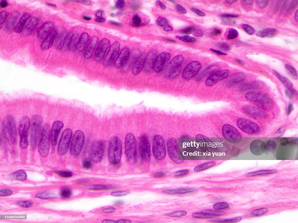 Simple Columnar Epithelium 100x