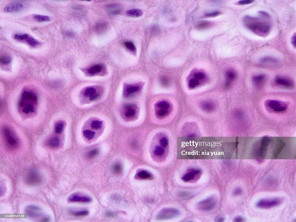 Elastic Cartilage,100x light micrograph