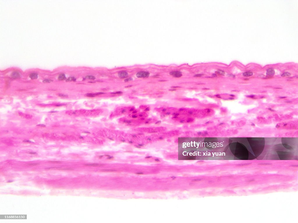 Transitional Epithelium Of The Urinary Bladder,40x light micrograph