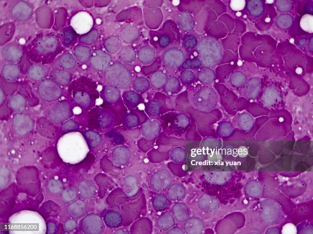 red bone marrow,100x light micrograph - blood cells microscope stock pictures, royalty-free photos & images