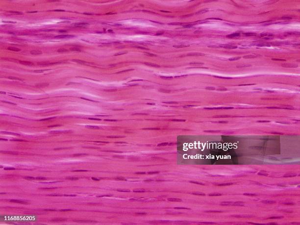 tendon,40x light micrograph - músculo humano fotografías e imágenes de stock