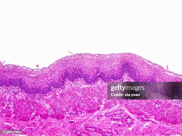 stratified squamous epithelium,10x light micrograph - stratified squamous epithelium stock pictures, royalty-free photos & images