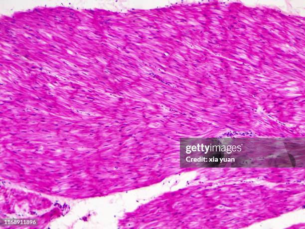 smooth muscle longitudinal section,10x light micrograph - smooth muscle stock pictures, royalty-free photos & images