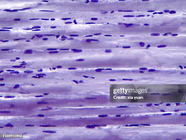 skeletal muscle fibres longitudinal section,40x light micrograph - músculo esquelético imagens e fotografias de stock