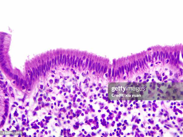 simple columnar epithelium,40x light micrograph - cellulose stockfoto's en -beelden