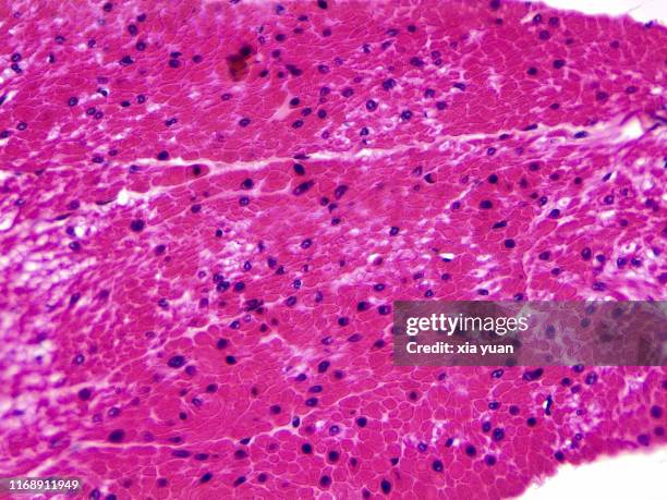 smooth muscle cross section,40x light micrograph - 平滑筋 ストックフォトと画像