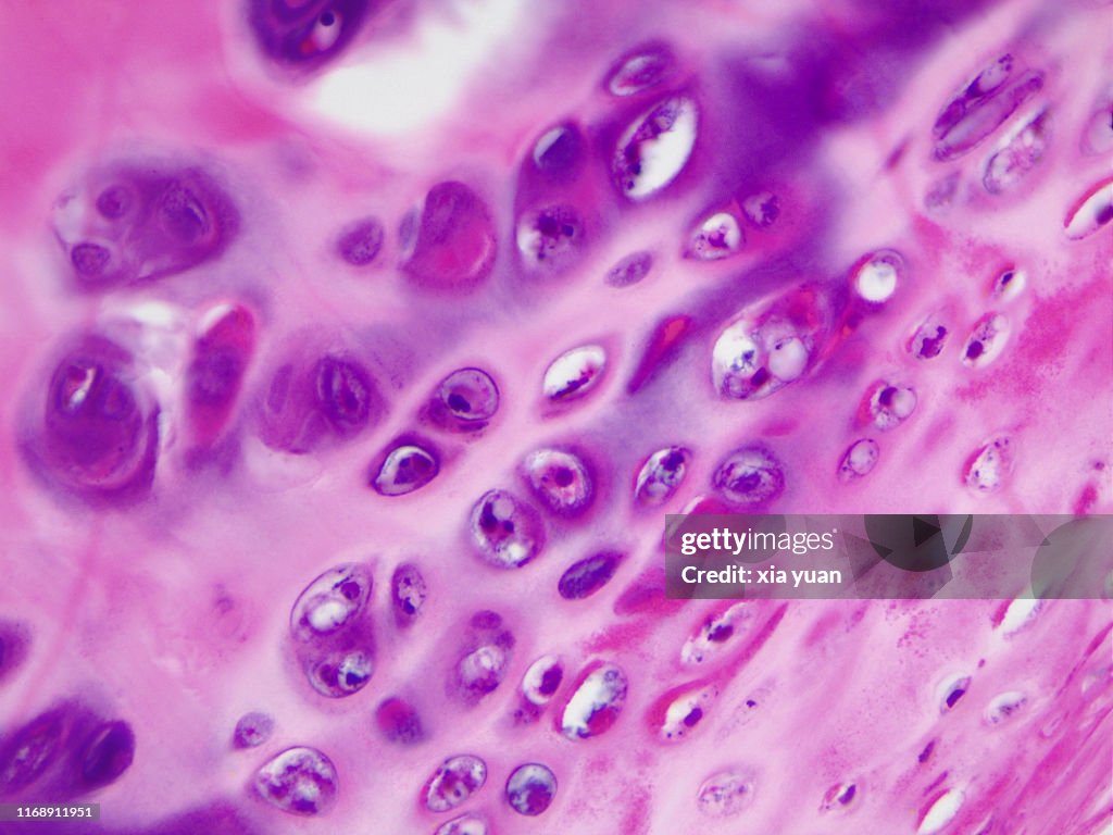 Hyaline Cartilage 40x Light Micrograph High-Res Stock Photo - Getty Images