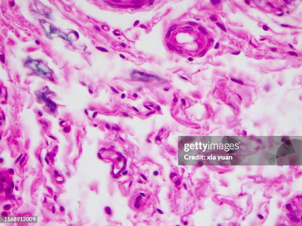 loose connective tissue,40x light micrograph - elastisch weefsel stockfoto's en -beelden