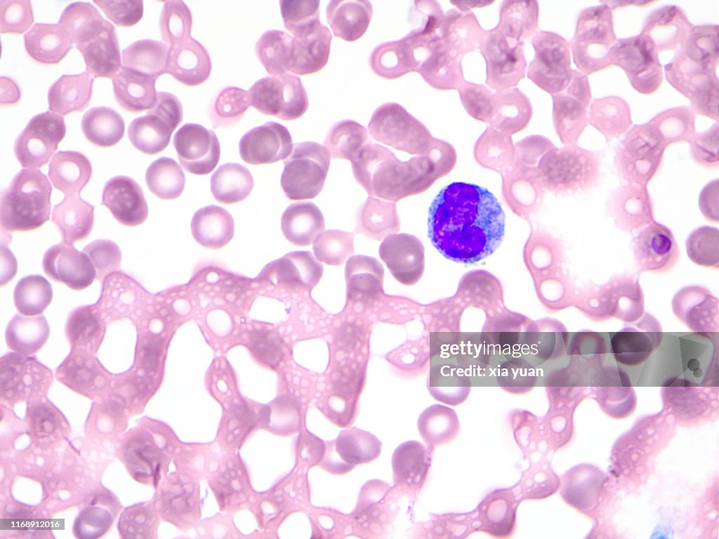 Monocyte Microscope Apr Blood Cells With A Monocyte 100x Light Micrograph High-Res Stock Photo ...