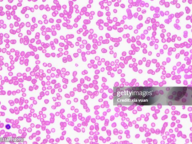 red blood cells,40x light micrograph - globulo rosso foto e immagini stock