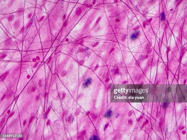 elastic fiber and collagenous fiber,40x light micrograph - elastisch weefsel stockfoto's en -beelden