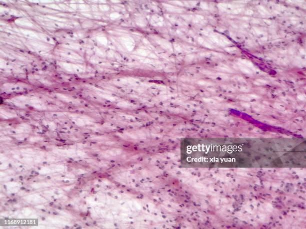 subcutaneous tissue,10x light micrograph - lederhuid stockfoto's en -beelden