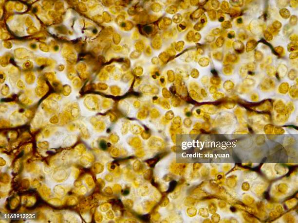 Lymph Node In Microscope 62 Lymph Node Microscope Stock Photos, High-Res Pictures, and Images ...