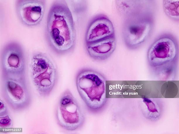 Hyaline Inclusions Hyaline Cartilage Connective Tissue Photos and Premium High Res ...