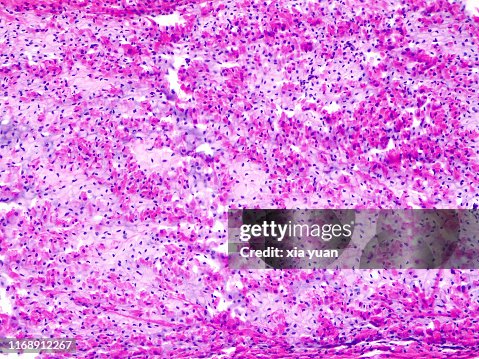 Dense Connective Tissue,10x light micrograph Dense Connective Tissue,10x light micrograph