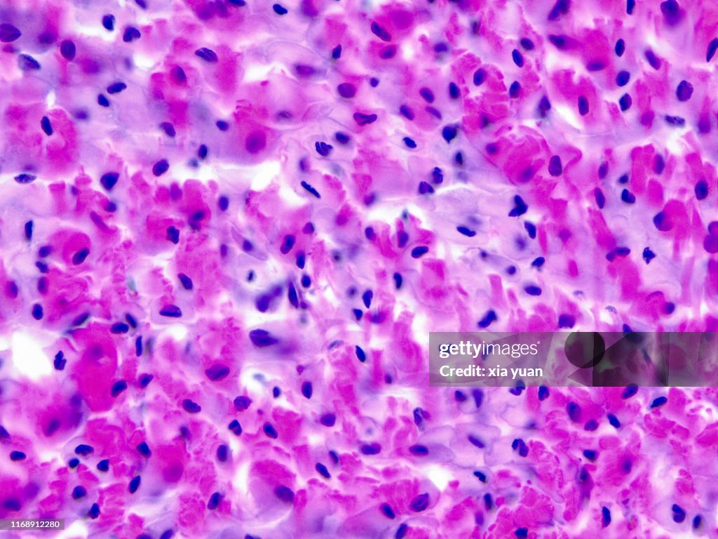 Dense Connective Tissue,40x light micrograph