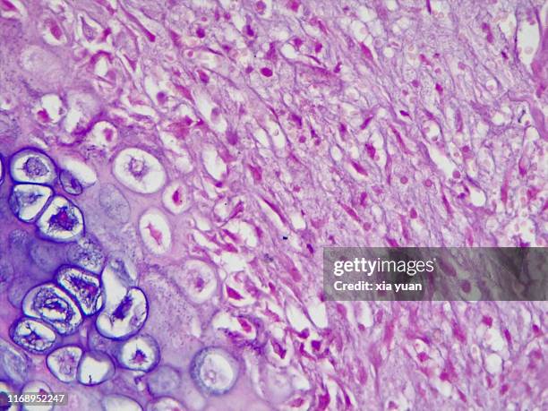 fracture callus,40x light micrograph - bones pattern stock pictures, royalty-free photos & images