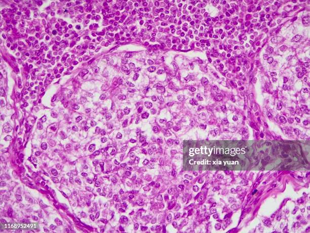 Lymph Node In Microscope Lymph Node Microscope Fotografías e imágenes de stock - Getty Images