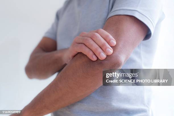 man touching his elbow in pain - elbow stockfoto's en -beelden