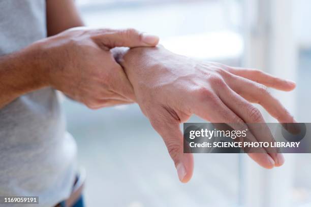 man touching his wrist in pain - carpaletunnelsyndroom stockfoto's en -beelden