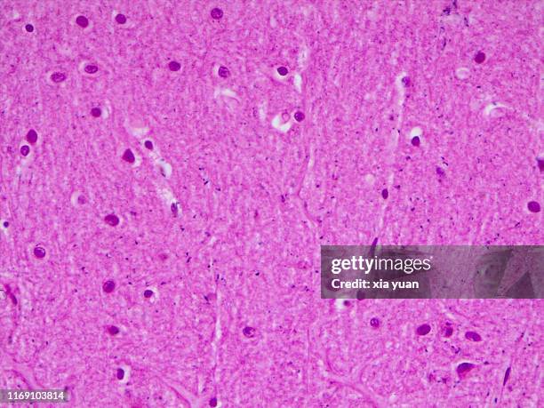 Cortex Microscope Brain Neuron Microscope Photos and Premium High Res Pictures - Getty Images
