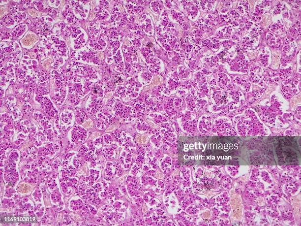 pituitary gland,10x light micrograph - endocrine-system stock pictures, royalty-free photos & images