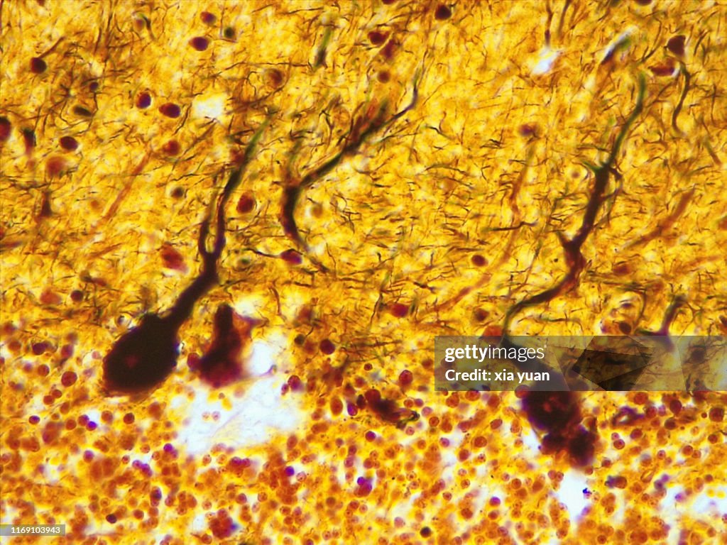 Purkinje Nerve Cells,40x light micrograph