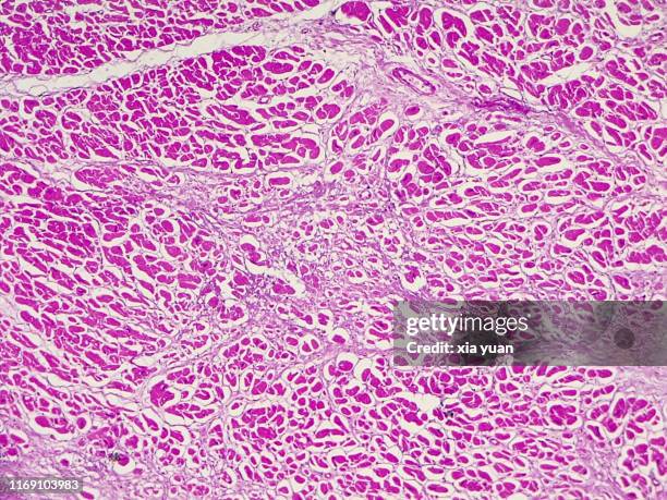 myocardial infarction (heart attack),10x light micrograph - cardiac muscle tissue stock pictures, royalty-free photos & images