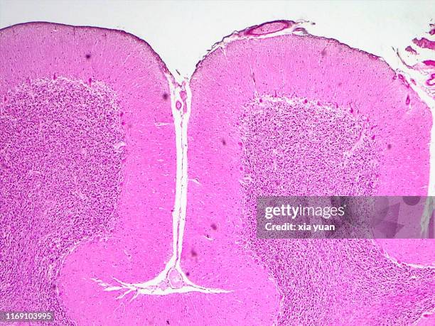 human cerebellum,4x light micrograph - histologia - fotografias e filmes do acervo