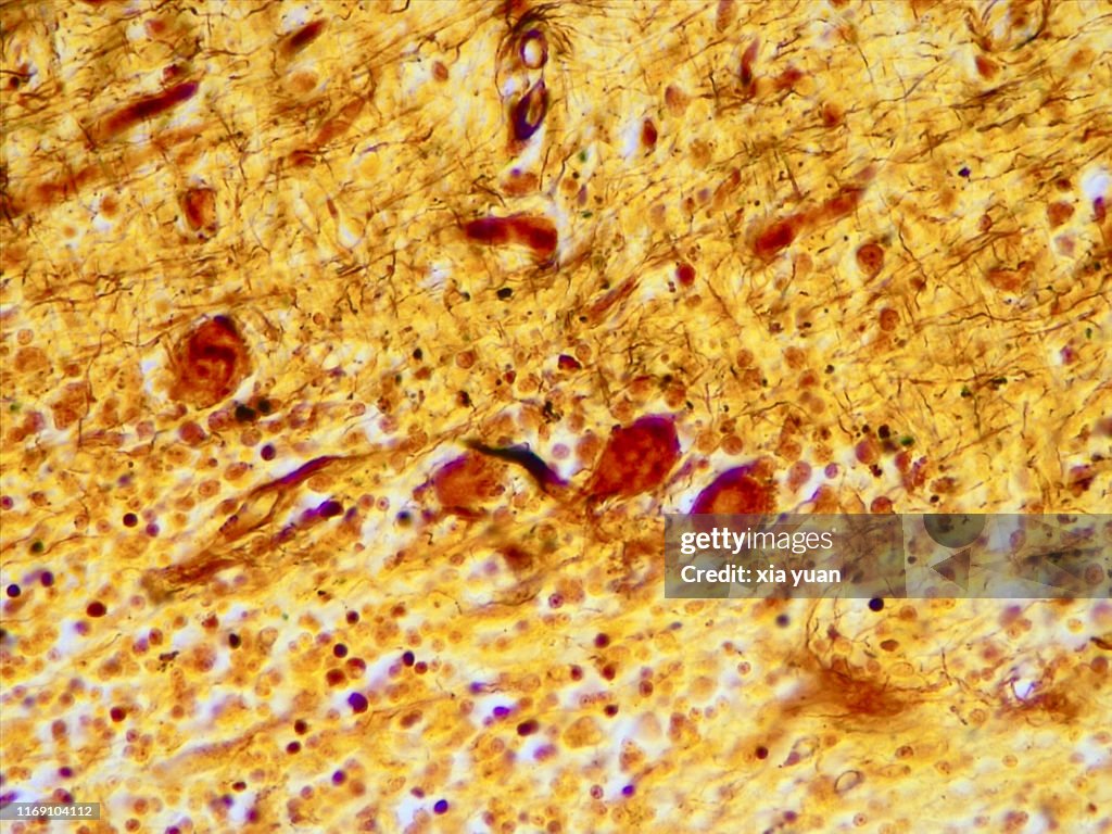 Purkinje Nerve Cells,40x light micrograph