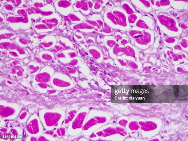 myocardial infarction (heart attack),40x light micrograph - cardiac muscle tissue stock pictures, royalty-free photos & images