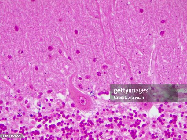 purkinje nerve cells,40x light micrograph - ヘマトキシリンエオジン染色 ストックフォトと画像