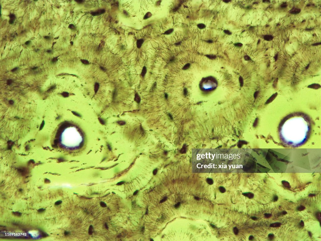 Compact Bone Cross Section,40x light micrograph