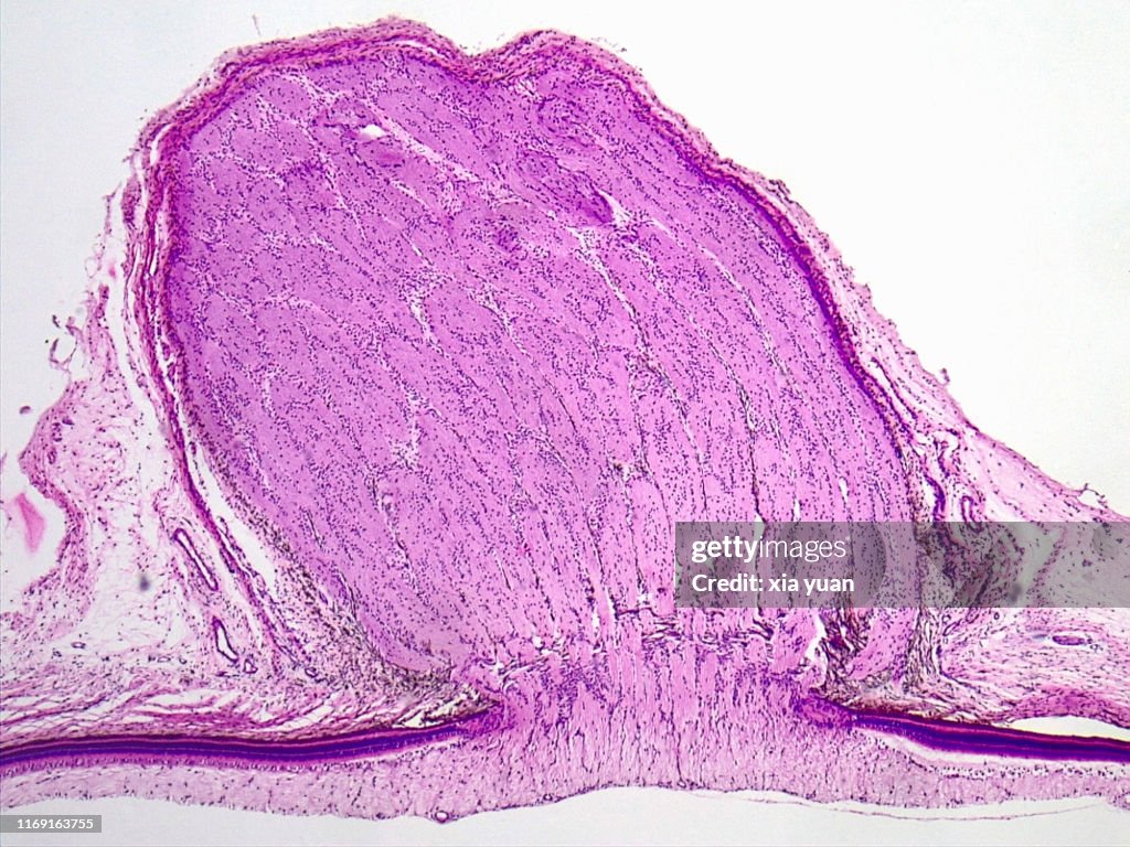 Sagittal Plane of Eyeball Tissue With Optic Nerve,4x light micrograph