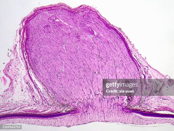 sagittal plane of eyeball tissue with optic nerve,4x light micrograph - nerf optique photos et images de collection