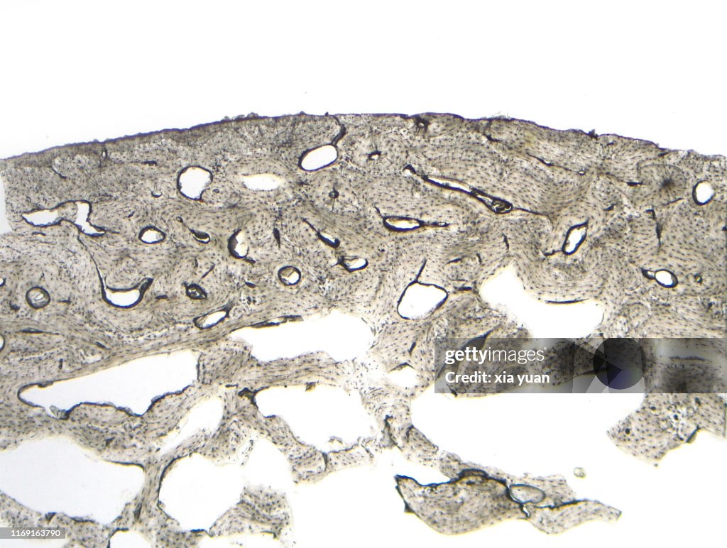 Cross Ground Section Of Compact Bone,4x light micrograph