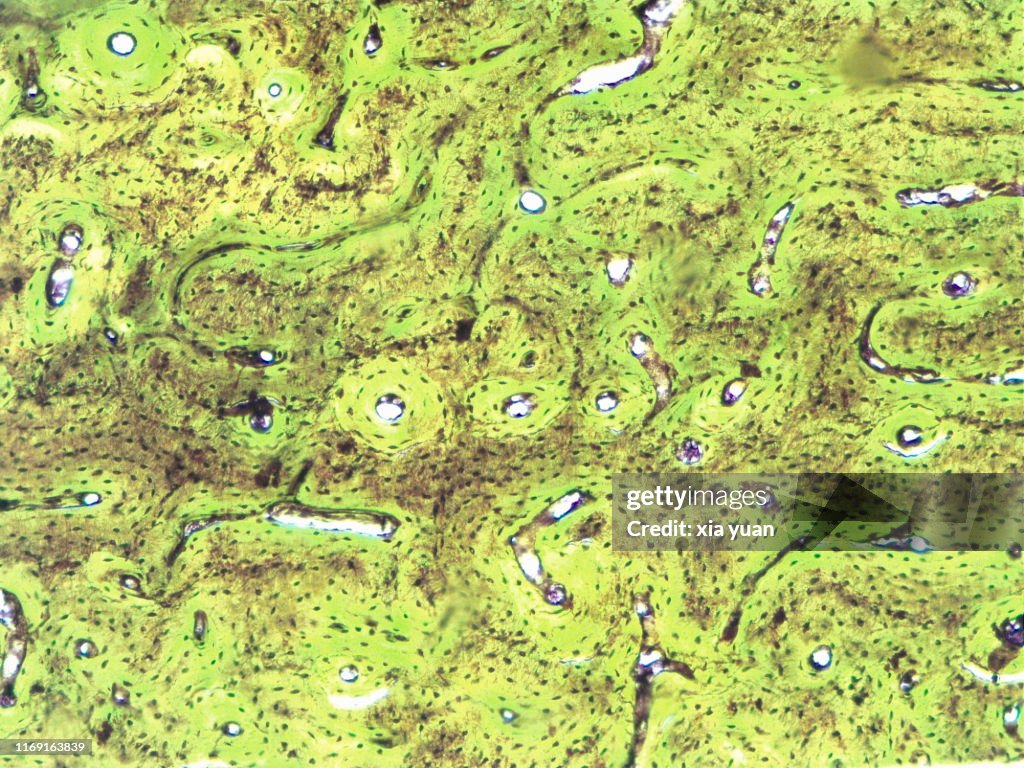 Compact Bone Cross Section,10x light micrograph