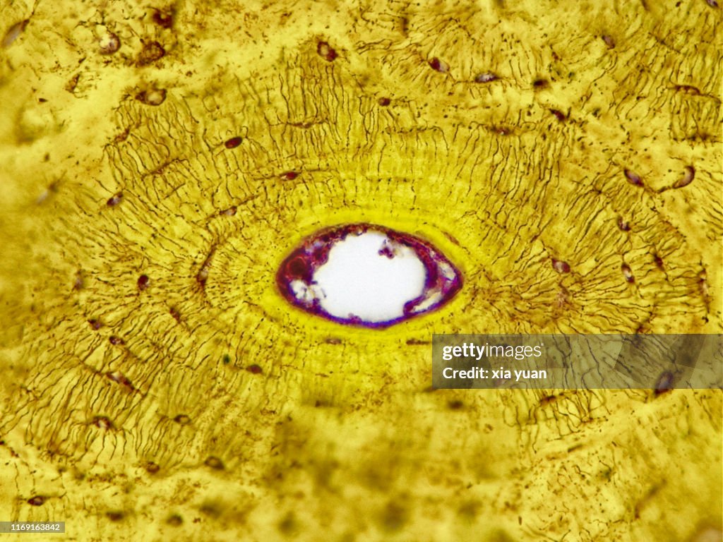 Compact Bone Cross Section,40x light micrograph