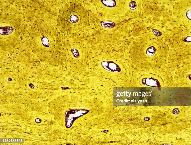 compact bone cross section,10x light micrograph - histology 個照片及圖片檔