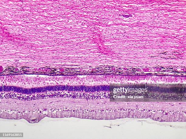 sagittal plane of eyeball tissue,10x light micrograph - hematoxylin and eosin staining stockfoto's en -beelden