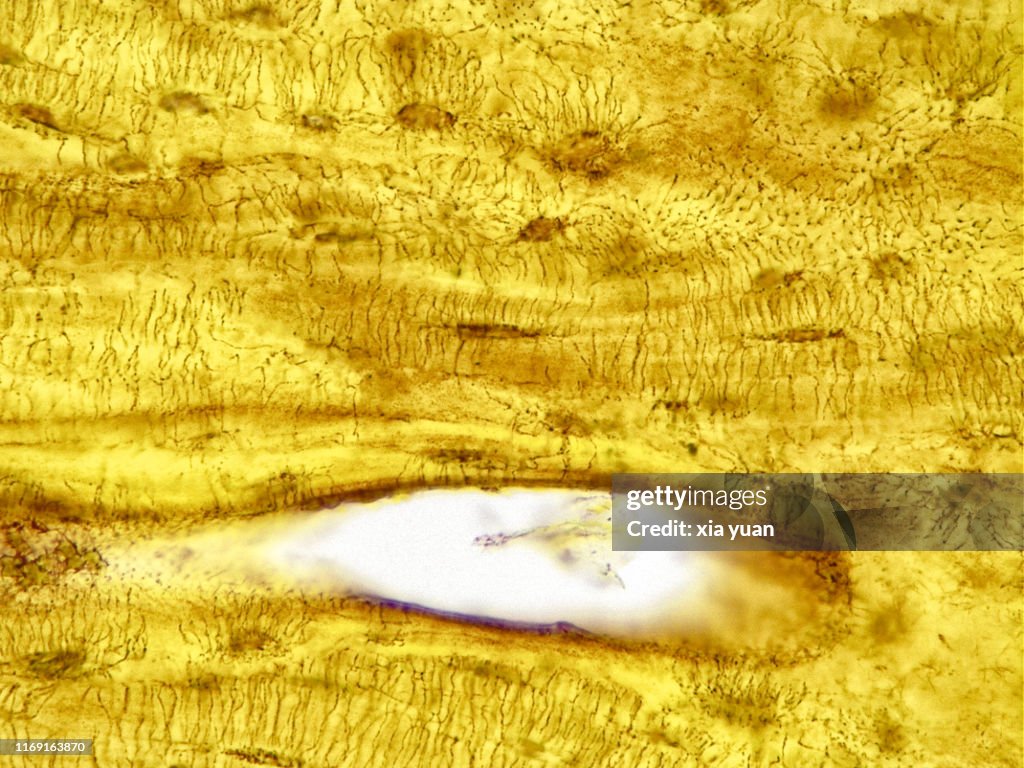 Compact Bone Longitudinal Section,40x light micrograph