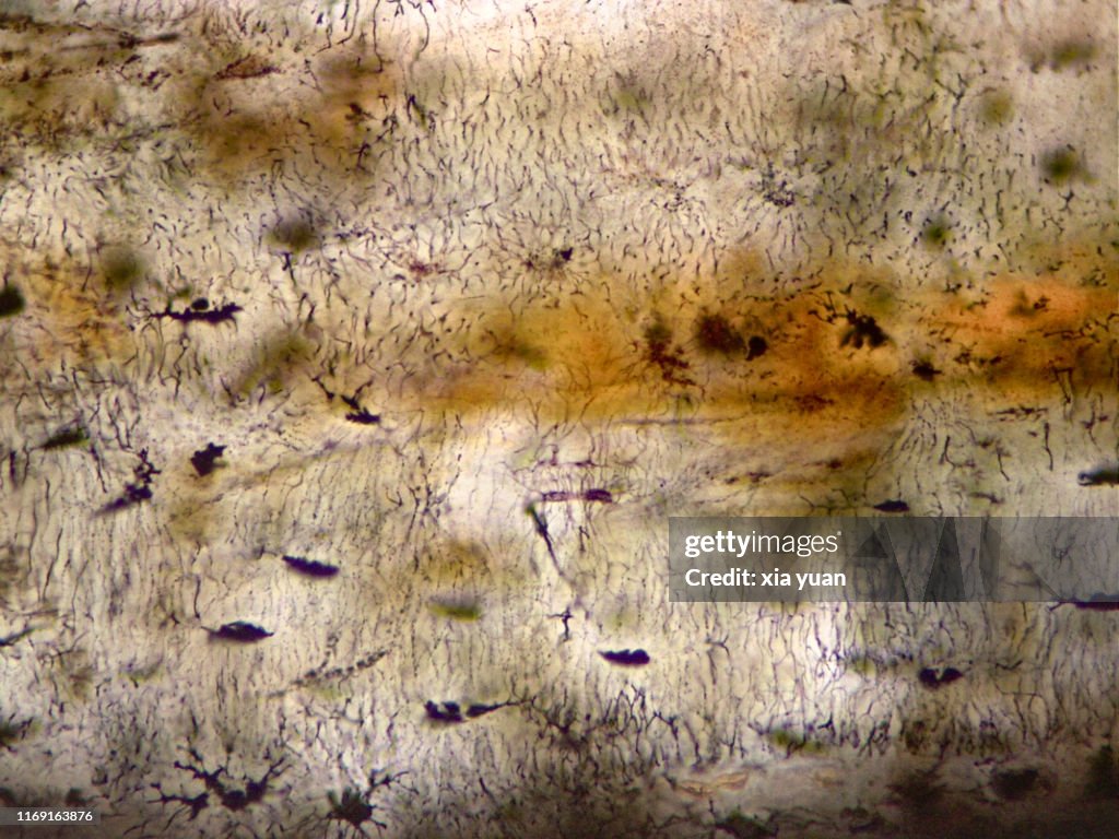 Longitudinal Ground Section Of Compact Bone,40x light micrograph