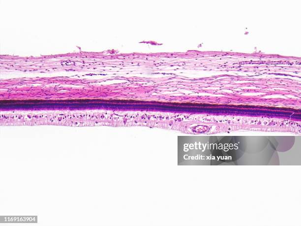 sagittal plane of eyeball tissue,10x light micrograph - scientific imaging technique fotografías e imágenes de stock