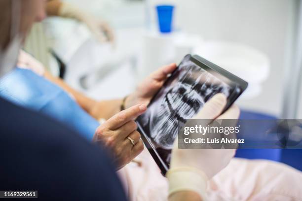 dentist and patient looking at teeth x-ray - orthodontist stock pictures, royalty-free photos & images